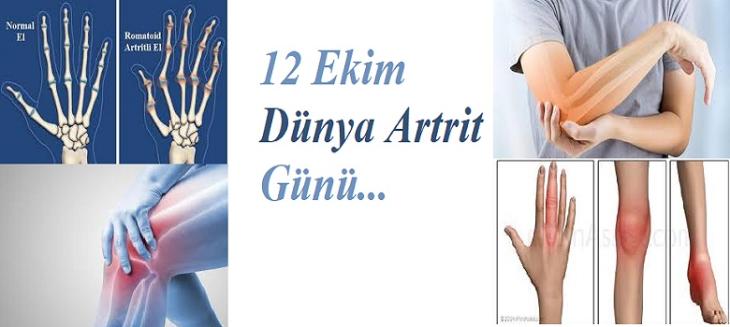 12 Ekim Dünya Artrit Günü 1996'dan beri tüm dünyada kutlanmakta olan küresel bir kampanyadır. Kampanyanın amacı romatizma ve kas-iskelet sistemi hastalıkları hakkındaki farkındalığı artırmaktır.